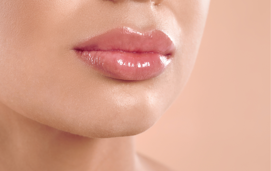 laser hair removal